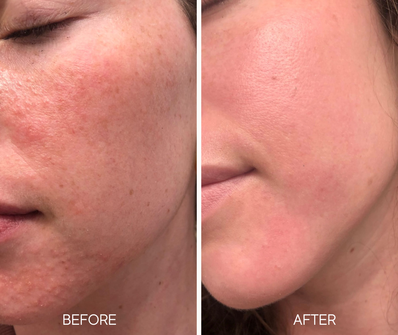 Lumielle Glass Skin Exfoliant