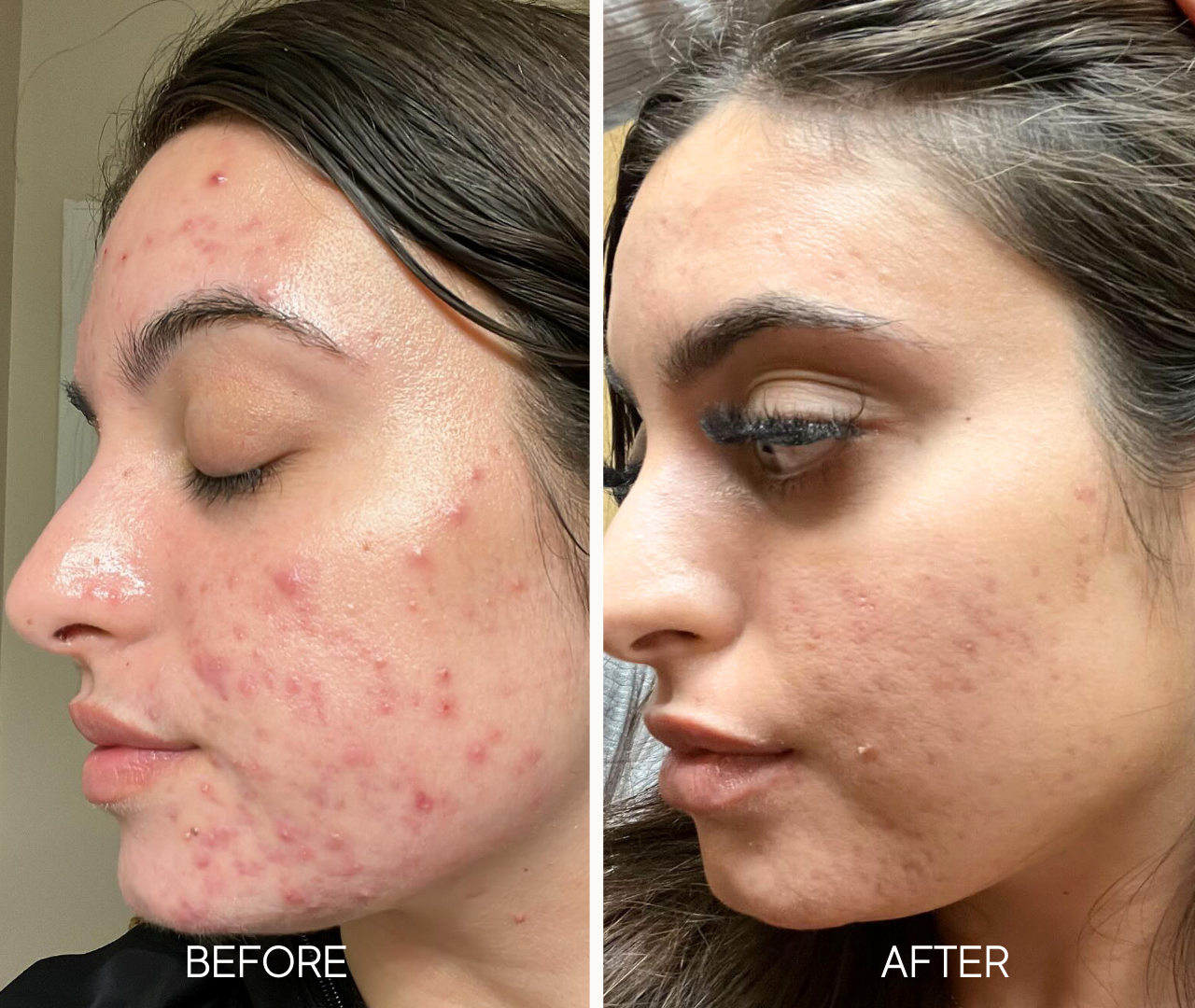 Lumielle Glass Skin Exfoliant