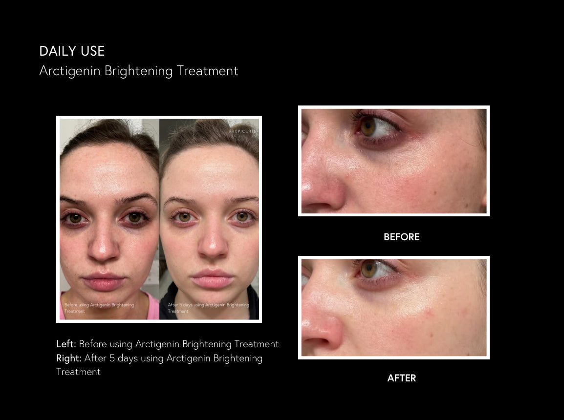 Epicutis Arctigenin Brightening Treatment