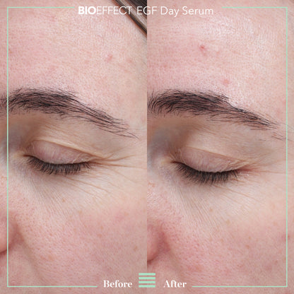 BIOEFFECT EGF Day Serum