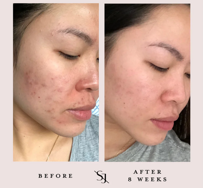 Saint Jane Luxury Beauty Serum - 9mL